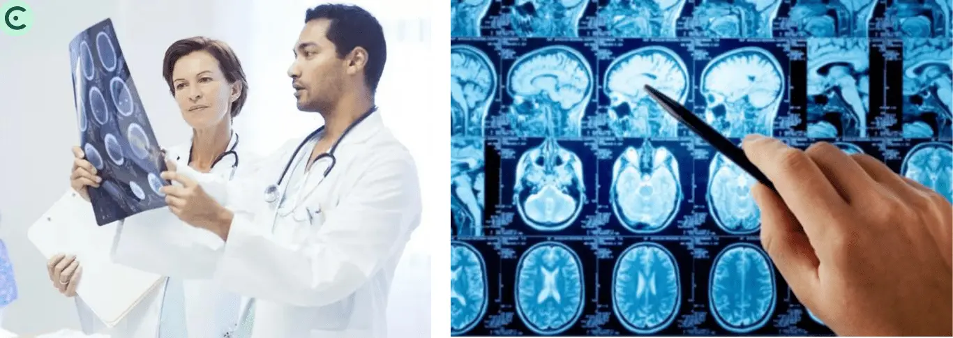 Top 10 Brain Tumors Surgeons in India